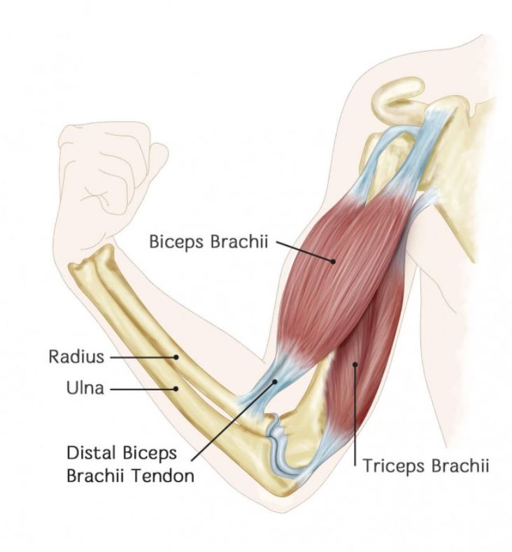 ripped bicep tendon