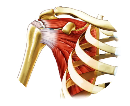 Rotator Cuff Injury - The Warren Firm, PLLC